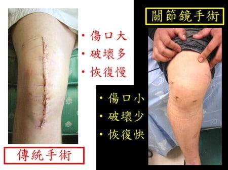 septic-knee (1)