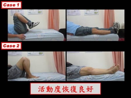 septic-knee (3)