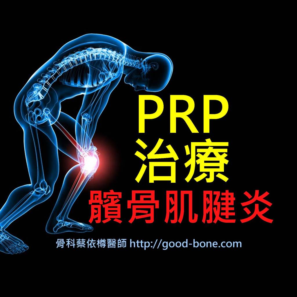 PRP 治療 髕骨肌腱炎 MB 骨科蔡依樽醫師 http://good-bone.com/