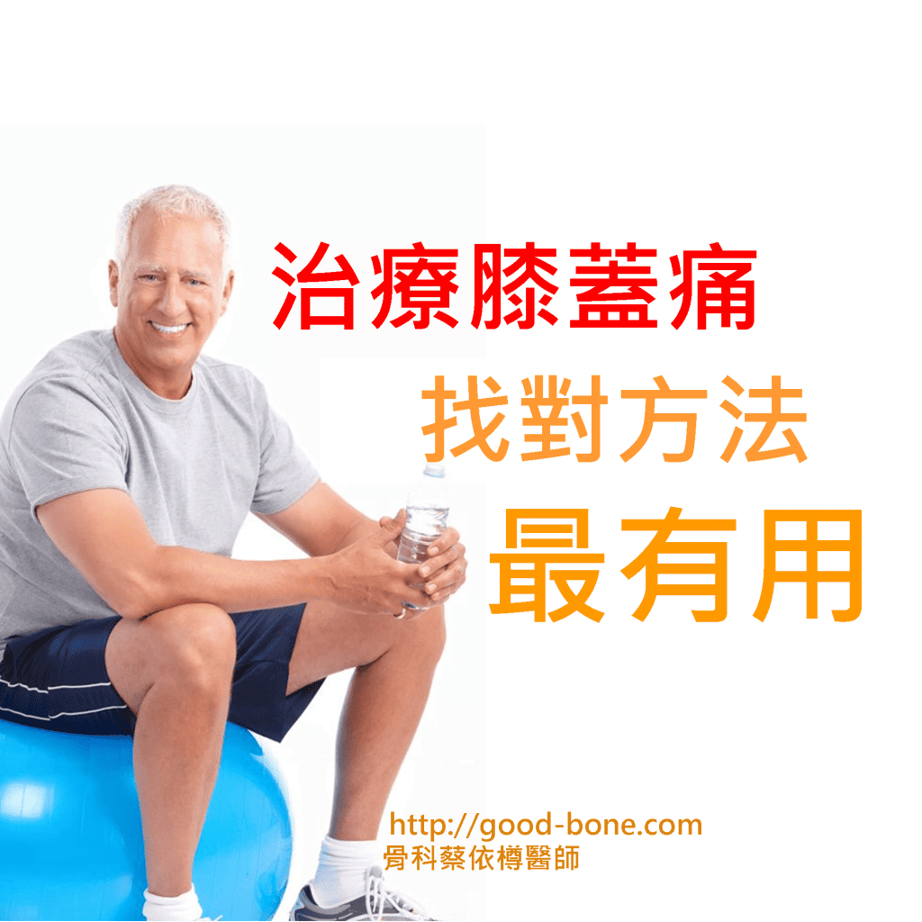 治療膝蓋痛 找對方法最有用 MB